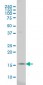 SURB7 Antibody (monoclonal) (M04)