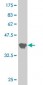 SURB7 Antibody (monoclonal) (M05)