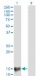 SURB7 Antibody (monoclonal) (M05)