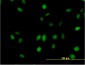 SURB7 Antibody (monoclonal) (M08)