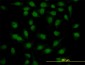 SURB7 Antibody (monoclonal) (M10)