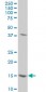 SURB7 Antibody (monoclonal) (M10)