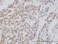 SYMPK Antibody (monoclonal) (M03)