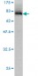 SYMPK Antibody (monoclonal) (M03)