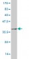 SYN1 Antibody (monoclonal) (M07)