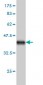 SYNJ1 Antibody (monoclonal) (M01)