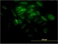 SYT11 Antibody (monoclonal) (M03)