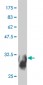 SYT11 Antibody (monoclonal) (M03)