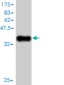 TAC3 Antibody (monoclonal) (M01)