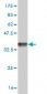 TACC3 Antibody (monoclonal) (M02)