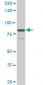 TACC3 Antibody (monoclonal) (M02)