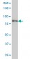 TACC3 Antibody (monoclonal) (M02)