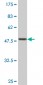 TAGLN Antibody (monoclonal) (M01)