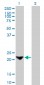 TAGLN Antibody (monoclonal) (M01)