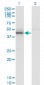 TARBP2 Antibody (monoclonal) (M04)