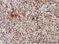 TARDBP Antibody (monoclonal) (M01)