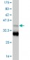 TBX18 Antibody (monoclonal) (M06)