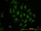 TBX3 Antibody (monoclonal) (M02)