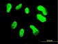 TBX3 Antibody (monoclonal) (M06)