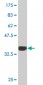 TBX3 Antibody (monoclonal) (M06)