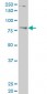 TBX3 Antibody (monoclonal) (M06)