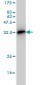 TCF19 Antibody (monoclonal) (M01)