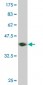 TCF2 Antibody (monoclonal) (M06)