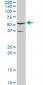 TCF2 Antibody (monoclonal) (M06)