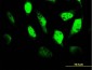 TCF4 Antibody (monoclonal) (M03)