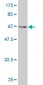 TCF4 Antibody (monoclonal) (M04)