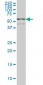 TCF7L2 Antibody (monoclonal) (M03)