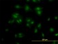 TCF7L2 Antibody (monoclonal) (M06)