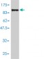 TDP1 Antibody (monoclonal) (M01)