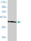 TEBP Antibody (monoclonal) (M01)