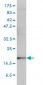 TEBP Antibody (monoclonal) (M01)