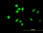 TESK2 Antibody (monoclonal) (M01)