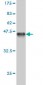 TESK2 Antibody (monoclonal) (M01)