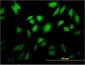 TESK2 Antibody (monoclonal) (M02)