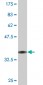 TFEC Antibody (monoclonal) (M08)
