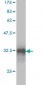 TFF1 Antibody (monoclonal) (M02)