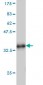 TFF1 Antibody (monoclonal) (M03)