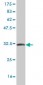 TFF3 Antibody (monoclonal) (M01)