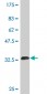 TFF3 Antibody (monoclonal) (M02)