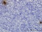 TFPI2 Antibody (monoclonal) (M01)
