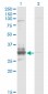 TFPI2 Antibody (monoclonal) (M01)