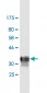 TFRC Antibody (monoclonal) (M01)