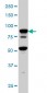 TFRC Antibody (monoclonal) (M01)