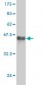 TGIF2 Antibody (monoclonal) (M01)