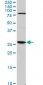 TGIF2 Antibody (monoclonal) (M01)