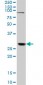 TGIF2 Antibody (monoclonal) (M01)